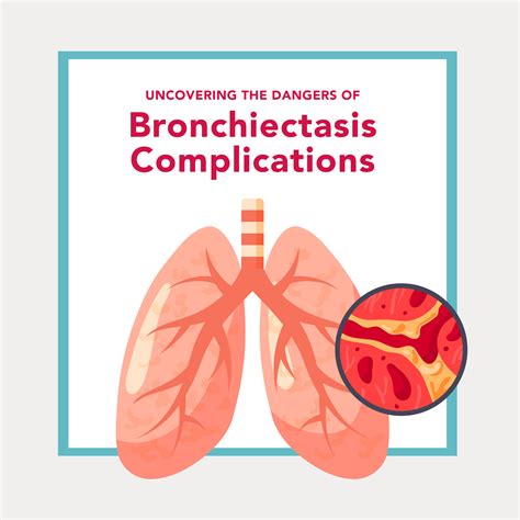 Bronchiectasis Complications: What’s at Risk? | SmartVest