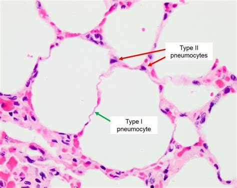 Gas exchange: Alveoli-Veterinary Histology | Krediblog