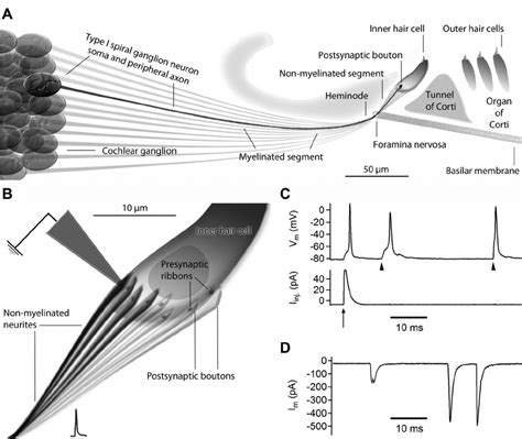 Type I spiral ganglion neuron physiology in the acutely explanted organ ...