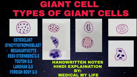 GIANT CELL | Types of Giant Cells | Pathology - YouTube