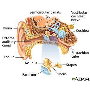 Cerumen Impaction - What You Need to Know