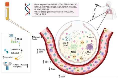 Biomedicines | Free Full-Text | Markers of Bronchiolitis Obliterans Syndrome after Lung ...