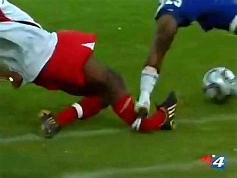 Worst Soccer Injuries (15 pics)