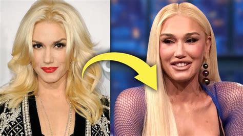 Gwen Stefani Plastic Surgery: Transformation Analysis | PlasticSurgeryInsights.com