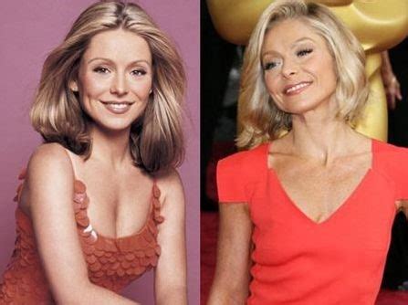 Kelly Ripa before and after plastic surgery (6) | Celebrity plastic ...