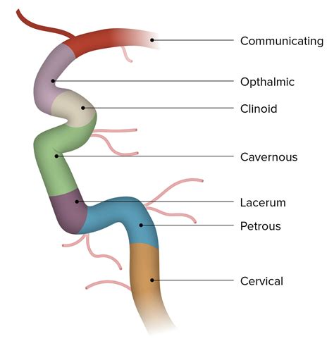 Intracranial Internal Carotid Artery Anatomy | Hot Sex Picture