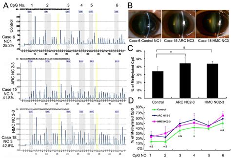 CpG island methylation in the a A-crystallin promoter was similar in... | Download Scientific ...