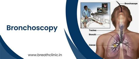 Bronchoscopy Test in Jaipur, Rajasthan | Dr. Pankaj Gulati