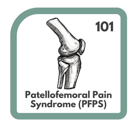 Patellofemoral Pain Syndrome 101 - Function101 Chiro + Physio