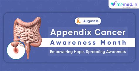 Appendix Cancer: The Enigma of a Rare Disease - MrMed