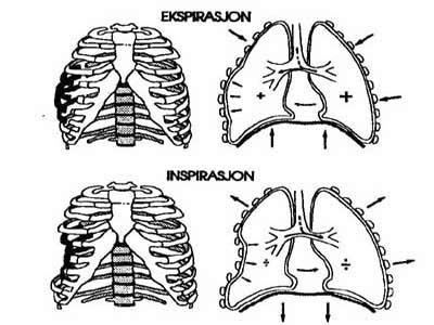 Flail Chest Diagram