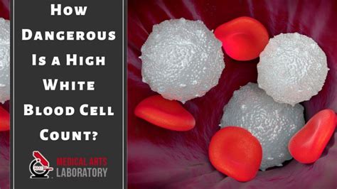 How Dangerous Is a High White Blood Cell Count?