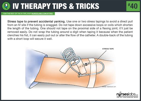 55 IV Therapy Tips and Tricks for Intravenous Nurses: The Ultimate Guide