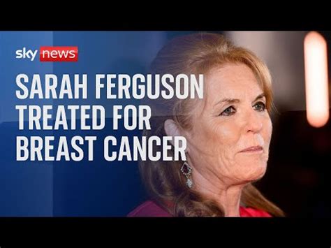 Sarah Ferguson treated for breast cancer - The Global Herald