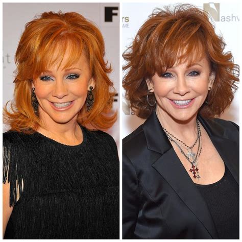 Reba McEntire Plastic Surgery? See Her Transformation