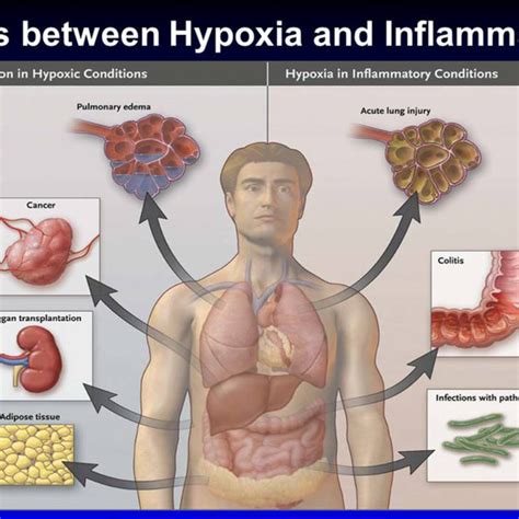 Overview of clinical conditions characterized primarily by tissue... | Download Scientific Diagram