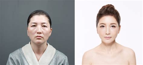 The most popular plastic surgery in Korea - Business Insider