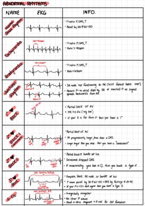 Ekg ; Ekg | Medical surgical nursing, Nursing school notes, Nursing notes