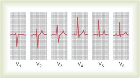 How to read a normal ECG(Electrocardiogram)? | HubPages