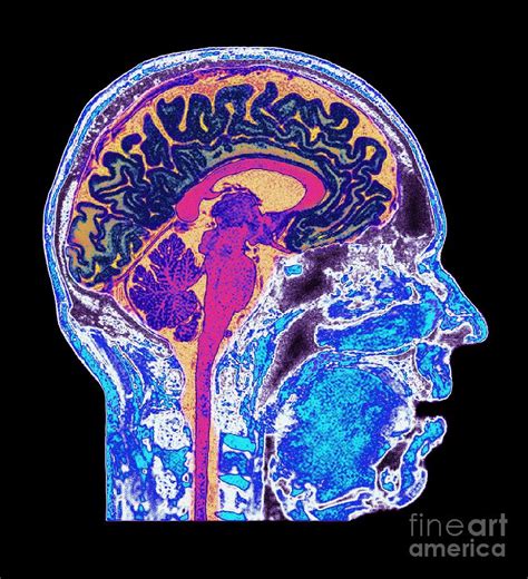 Normal Human Brain, Mri Scan Photograph by Du Cane Medical Imaging Ltd ...