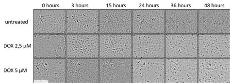 Cytotoxicity assay - zenCELL owl -Microscopy for the incubator