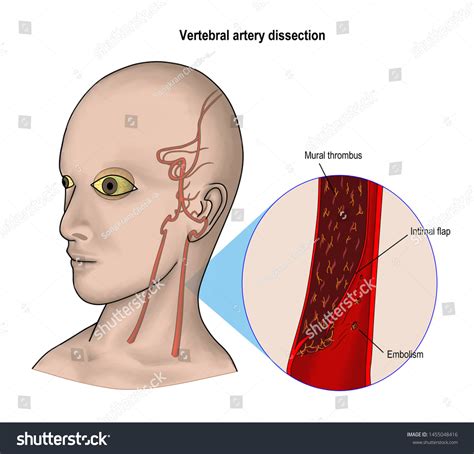 Head Dissection Photos and Images | Shutterstock