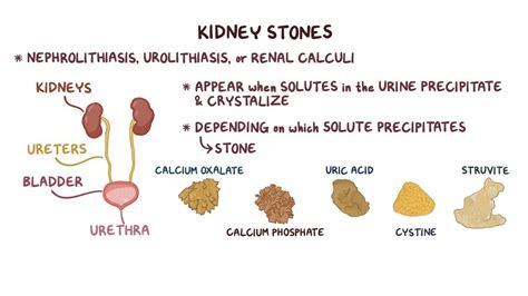 Renal Stones Types