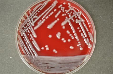 Klebsiella pneumoniae has colonies that look like snot. Note how big ...