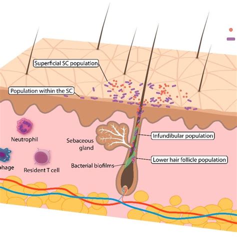 Overview of the skin (pilosebaceous unit) and the C. acnes population... | Download Scientific ...