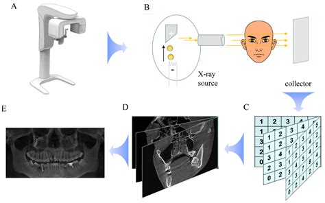 The Application of Deep Learning on CBCT in Dentistry