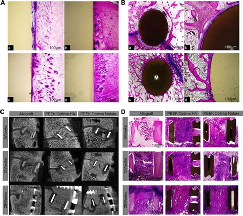 Frontiers | Biomaterials for Interbody Fusion in Bone Tissue Engineering