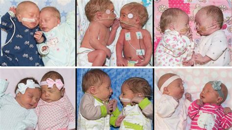 PHOTOS: 6 sets of twins born all in the same week, at same hospital ...