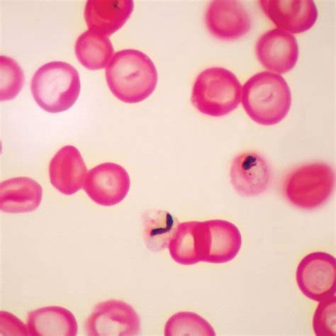 Plasmodium falciparum Slide, Smear | Carolina Biological Supply