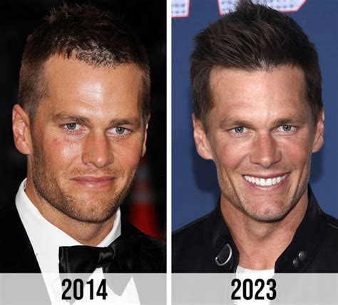 Tom Brady Plastic Surgery: The NFL Legend's Youthful Appearance — citiMuzik