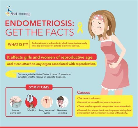 What Causes Endometriosis?