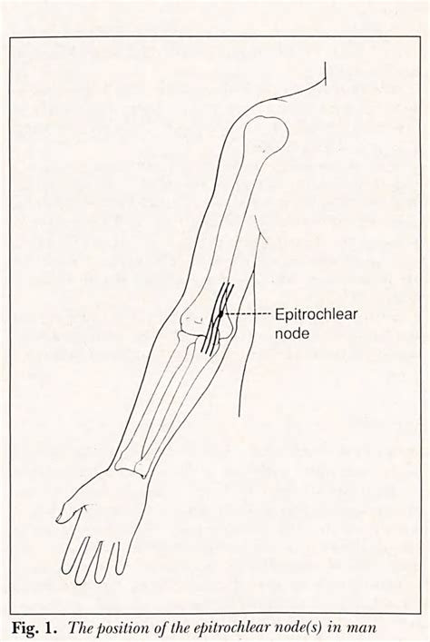 Structure of epitrochlear lymph node | Semantic Scholar