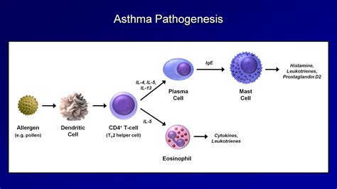 Asthma Pathophysiology Schematic/diagram Pathophysiology Of Asthma [58 ...