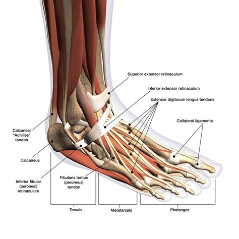 What Is Tendonitis?