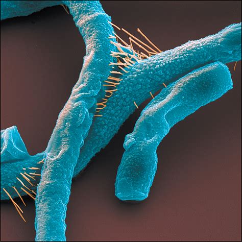 Anthrax Detection | Infectious Diseases | JAMA | The JAMA Network