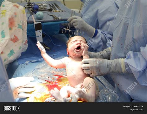 Baby Being Born Via Image & Photo (Free Trial) | Bigstock