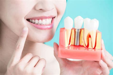 Dental Implant Pain and Recovery: What to Expect | Aurora Dental