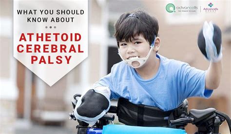 What You Should Know About Athetoid Cerebral Palsy? | POSTEEZY