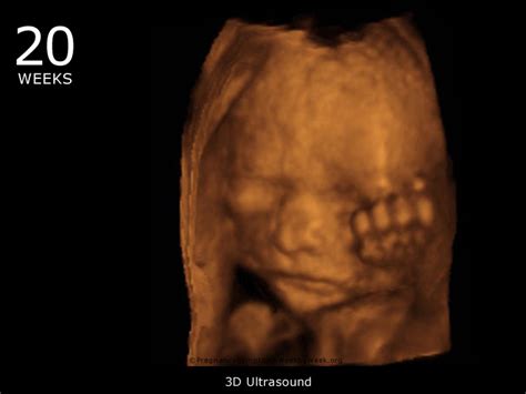 20 Week 3D Ultrasound Baby Picture | Pregnancy Symptoms Week by Week