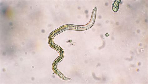 Roundworms In Stool