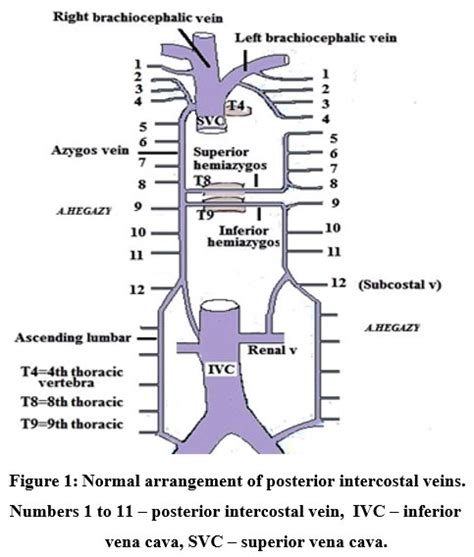 Posterior Intercostal Veins