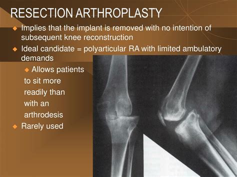 PPT - INFECTION AND TOTAL KNEE ARTHROPLASTY : DIAGNOSIS AND TREATMENT ...