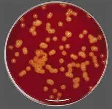 Columbia CNA Agar: Composition, Uses, and Results • Microbe Online