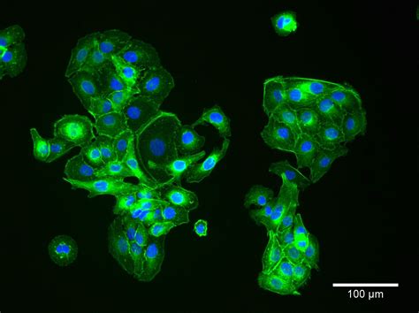 HaCaT cells