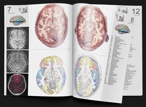 atlas of the human brain 4th edition