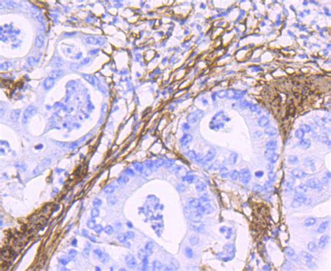 alpha smooth muscle Actin Rabbit mAb - SAB | Signalway Antibody